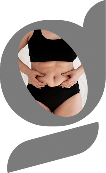  Cirurgia MILA